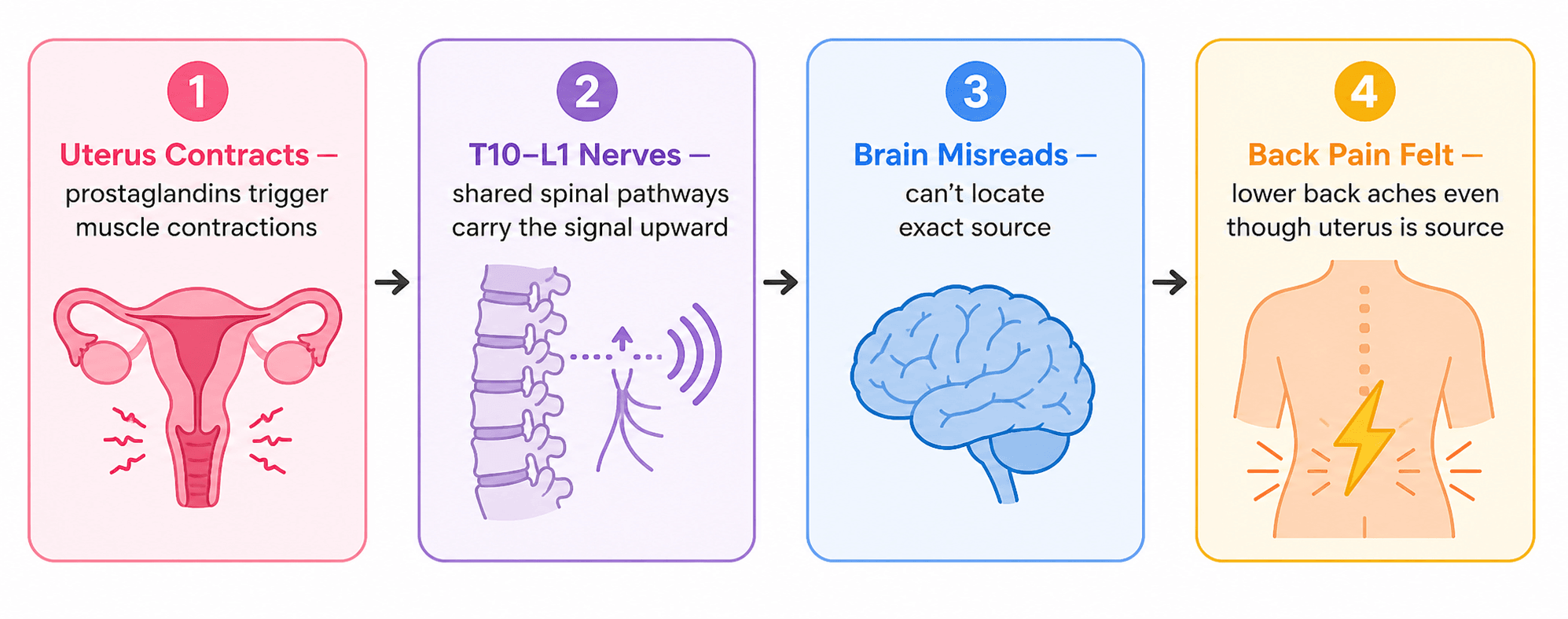 Diagram showing T10-L1 nerve pathway connecting uterus to lower back pain